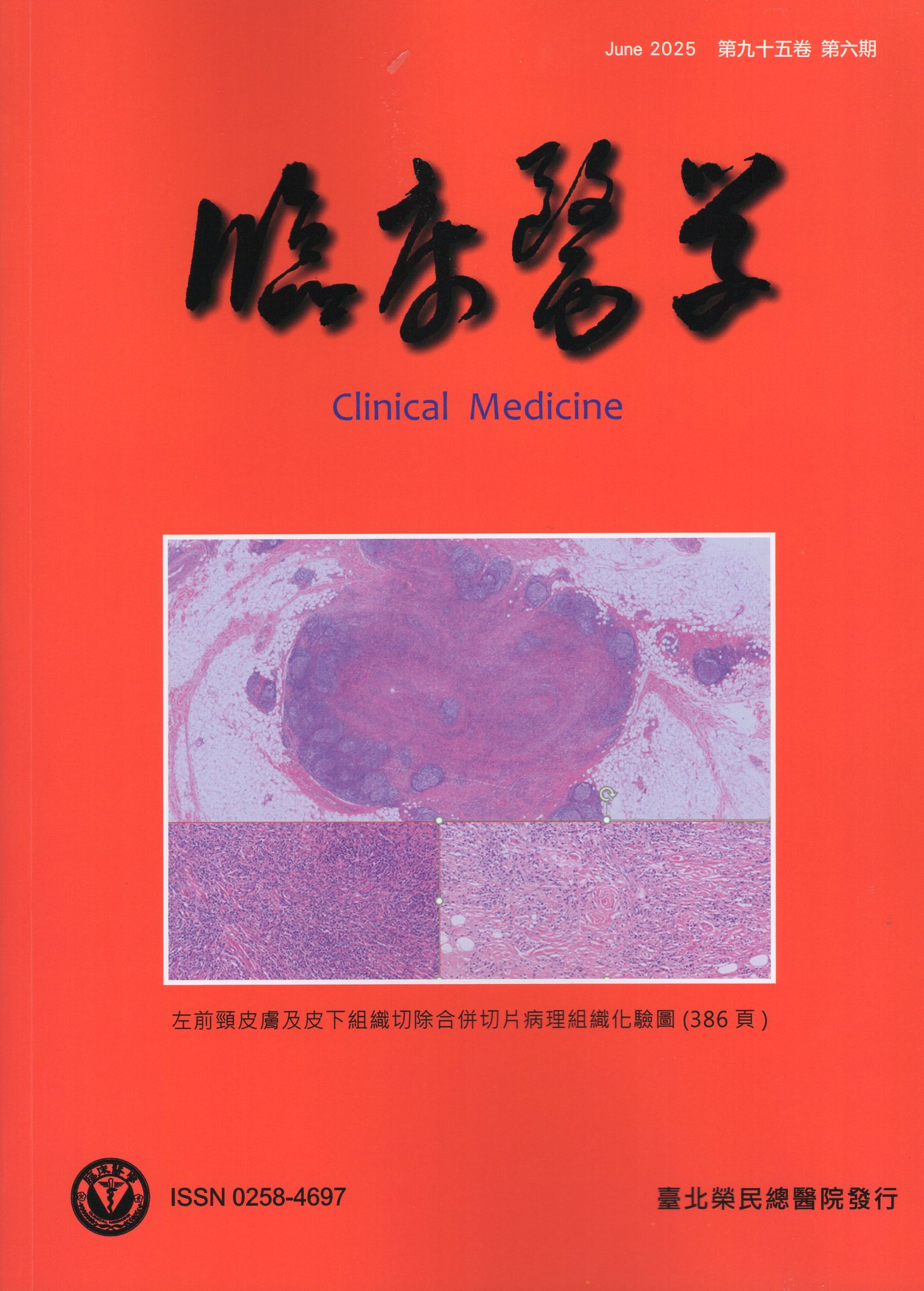 臨床醫學．第九十五卷第六期(114/